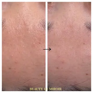 ビューティー ミロワールのエステ・リラクイメージ