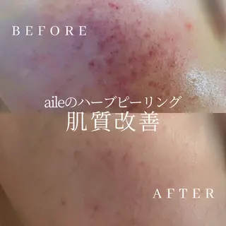 サロンド エルのエステ・リラクイメージ