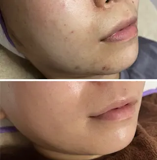 salon de SH'een所属・salon de SH'eenのマツエク・マツパデザイン