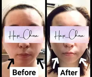 hapi_chura 《ハピちゅら》のエステ・リラクイメージ