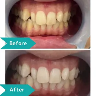 Twinkle White上尾店のエステ・リラクイメージ