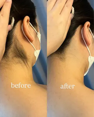 うなじ脱毛/美肌脱毛 LABELのエステ・リラクイメージ