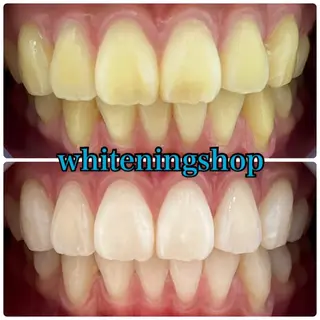 ホワイトニング ショップ吉祥寺店のエステ・リラクイメージ