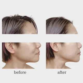 看護師 AYUIのエステ・リラクイメージ