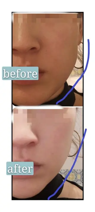 🅖🅤🅩🅔🅛 salonのエステ・リラクイメージ