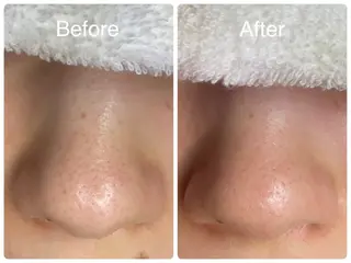 salon HATOのエステ・リラクイメージ