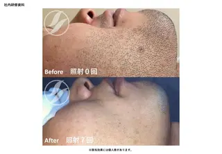 メンズ 腸もみ・メンズ脱毛・ 毛穴洗浄〜カナロア〜のエステ・リラクイメージ