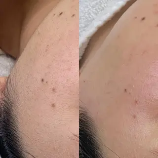 メンズ salonLADYSTYLE所属・稲嶺 美華のエステ・リラクイメージ