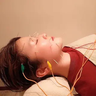 むくみたるみ専門☆ 美容鍼・小顔矯正のエステ・リラクイメージ