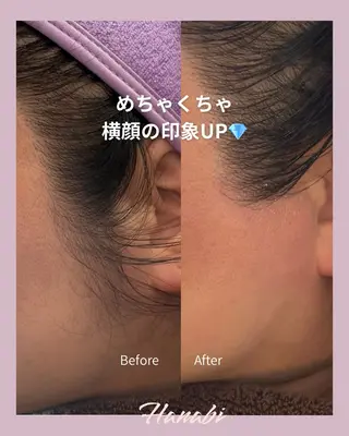 毛穴専門サロン Hanabiのエステ・リラクイメージ