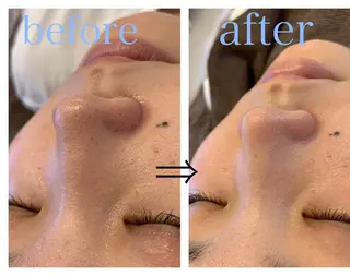 リジュベ所属・Rejuve ﾘｼﾞｭﾍﾞのエステ・リラクイメージ