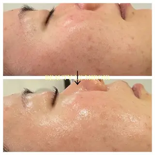 マツエク・マツパ ビューティー ミロワールのエステ・リラクイメージ