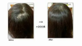 マツエク・マツパ 【痩身▪️体質改善ダイエット】美養サロンEnbi～縁美～所属・美養サロンEnbi ～縁美～のエステ・リラクイメージ