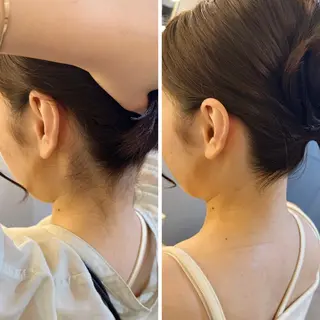 うなじ脱毛/美肌脱毛 LABELのエステ・リラクイメージ