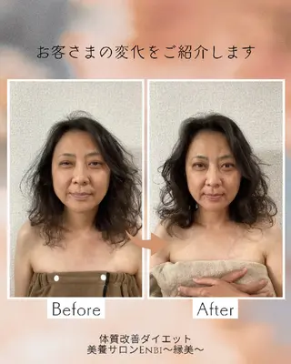 【痩身▪️体質改善ダイエット】美養サロンEnbi～縁美～所属・美養サロンEnbi ～縁美～のエステ・リラクイメージ