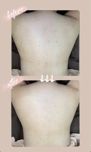 ベラージュ【美背中・ 美尻・フェイシャル】のエステ・リラクイメージ