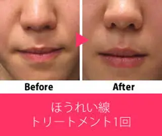 ビューティーラウンジ A&A✨佐藤✨のエステ・リラクイメージ