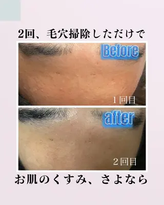 肌質改善サロン facialmoonのエステ・リラクイメージ