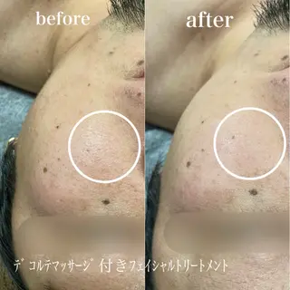 磐田｜LAYLA 一番丁寧な脱毛店のエステ・リラクイメージ