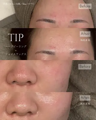 Mau beauty salon所属・Mau (マウ)のエステ・リラクイメージ