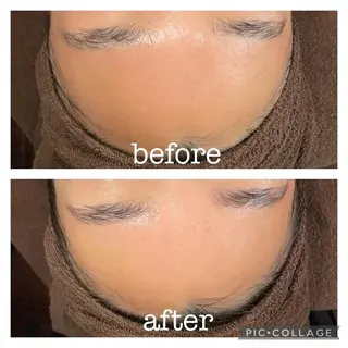 aesthetic laff所属・美肌作りのサロン 山村亜美のエステ・リラクイメージ