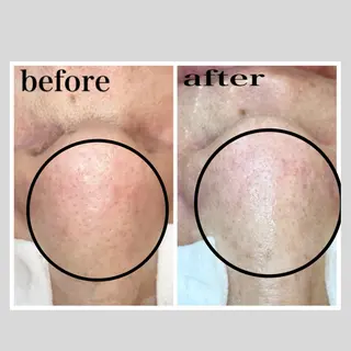 韓国肌管理 【毛穴専科】のエステ・リラクイメージ