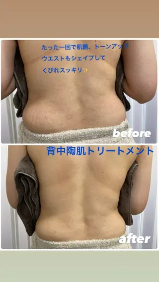 山崎 陽子のエステ・リラクイメージ