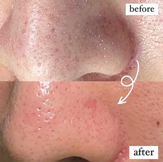 メンズ アイラッシュ＆フェイシャルサロン　ベアトリーチェ所属・医療提携美容サロン Beatriceのエステ・リラクイメージ