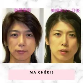MA CHÉRIE所属・体質別痩身&小顔 MA CHÉRIEのエステ・リラクイメージ