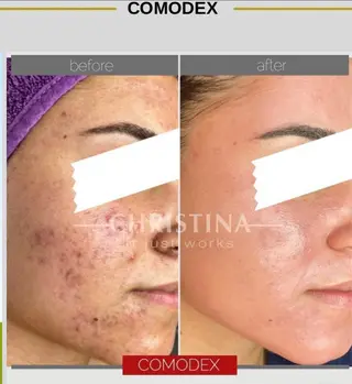 Meow！～トラブル肌専門ピーリング＆脱毛サロン～所属・トラブル肌改善🏥 Meow！🫧🫧のその他イメージ