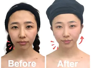 小顔整体美容を科学する【小顔FaceLabo.】横浜店所属・小顔FaceLabo 横浜店  篠原のエステ・リラクイメージ