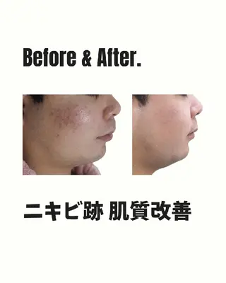 ユニセックスエステサロンUniclear所属・痩身&フェイシャル Uniclearのエステ・リラクイメージ