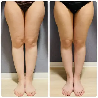 天満/asami/ 優しい筋膜リリースのエステ・リラクイメージ