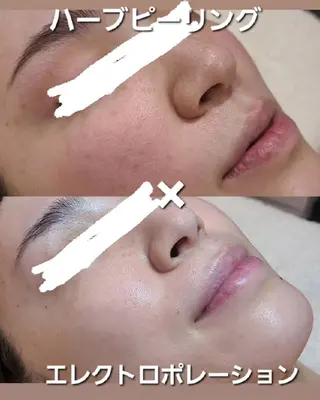 BEAUTYSARON　SiS.所属・高橋 沙奈江のエステ・リラクイメージ