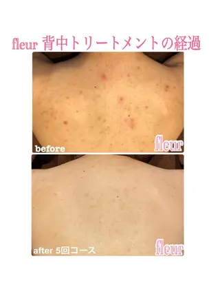 Fleur フルールのエステ・リラクイメージ