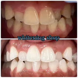 ホワイトニング ショップ吉祥寺店のエステ・リラクイメージ