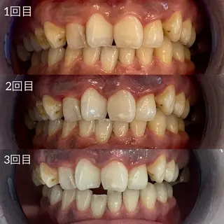 メンズ キッズ ホワイトニングサロン Ecru所属・ホワイトニングサロン Ecru エクリュのエステ・リラクイメージ