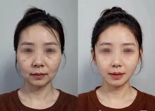 マツエク・マツパ aliaハイフ&水光ジェットサロン所属・aliaハーブ水光店 エステティシャン募集のエステ・リラクイメージ