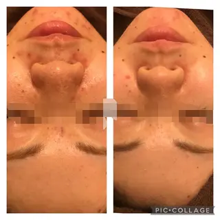 ミディアム カラー パーマ ヘアアレンジ メンズ キッズ マツエク・マツパ アニメ,Vオタク× 即効痩せエステサロンのエステ・リラクイメージ