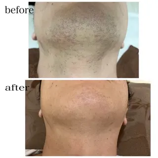 メンズ A/S アズのエステ・リラクイメージ