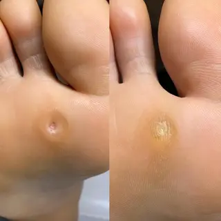 ネイル 深爪・巻き爪 専門サンセリテのネイルデザイン