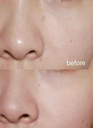 アイブロウ 愛維美水光美肌専門店所属・愛維美水光美肌専門店 メンズレディースokのエステ・リラクイメージ