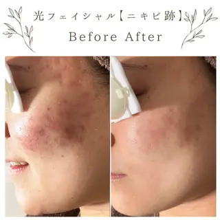 な ぎのエステ・リラクイメージ