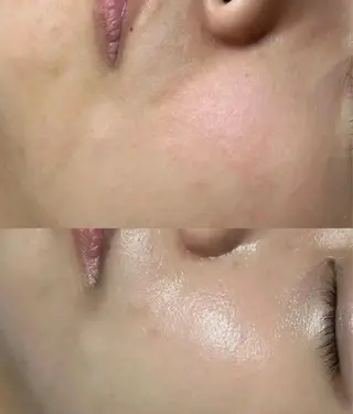 マツエク・マツパ aliaハイフ&水光ジェットサロン所属・aliaハーブ水光店 エステティシャン募集のエステ・リラクイメージ