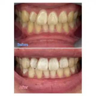 M渋谷店所属・Ｍ渋谷 ホワイトニングのエステ・リラクイメージ