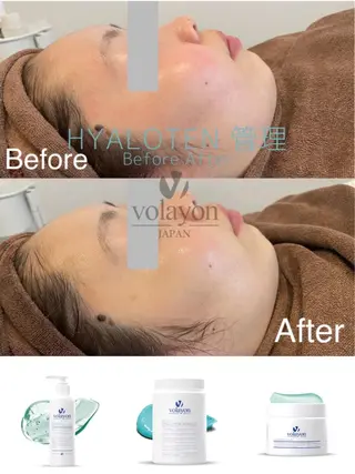 ウプエステティック所属・韓国肌管理 ウプエステティックのエステ・リラクイメージ