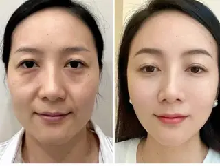 ネイル aliaハイフ&水光ジェットサロン所属・aliaハーブ水光店 エステティシャン募集のエステ・リラクイメージ