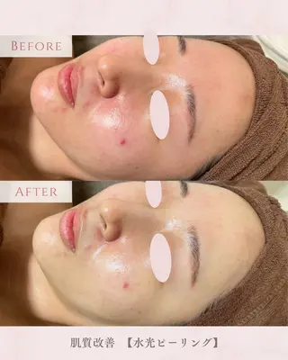 肌質改善サロン LesFleursのエステ・リラクイメージ