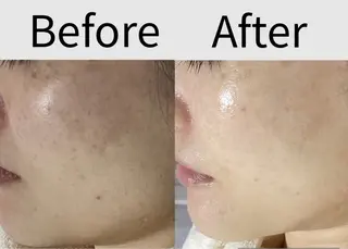 都度払い 肌質改善専門サロンのエステ・リラクイメージ