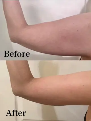 痩身ハイパーナイフ 小顔フェイシャル痩身のエステ・リラクイメージ